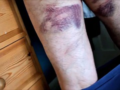 スパンキング, 妻