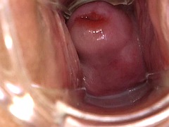 Nana, Fétiche, Gyneco