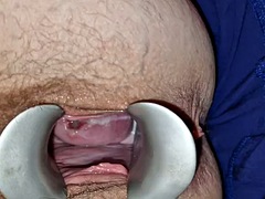 婦人科, 毛深い, マッサージ, 淫乱熟女, 磨き, おもちゃ, スカートのぞき, バイブレーター