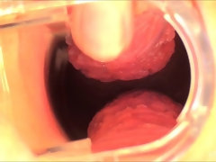 In den arsch, Nahaufnahme, Kleid, Extrem, Fingern, Klaffend, Masturbation, Öffentlich