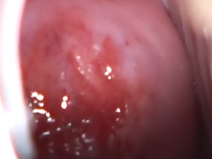 Amateur, Gode, Fétiche, Béant, Gyneco, Masturbation, Huilée, Adolescente